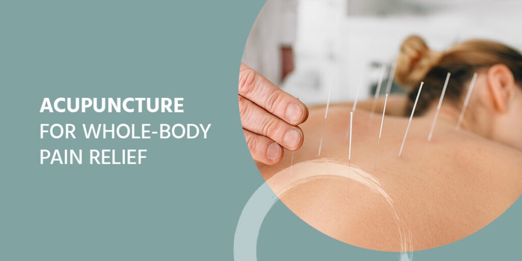 Acupuncture