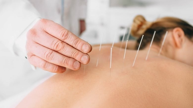 Bachelor in Acupuncture (B.Acu)
